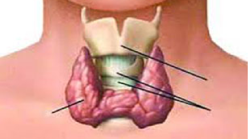 علائم پرکاری و کم کاری تیروئید در زنان و مردان