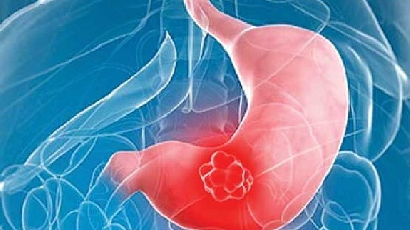 علائم زخم اثنی عشر 