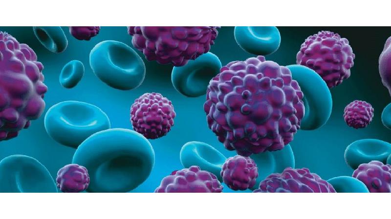 14 نشانه اولیه ابتلا به سرطان