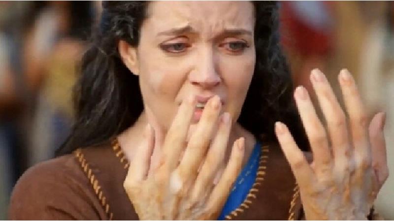 جذام چیست و چه کسانی به آن مبتلا می‌شوند