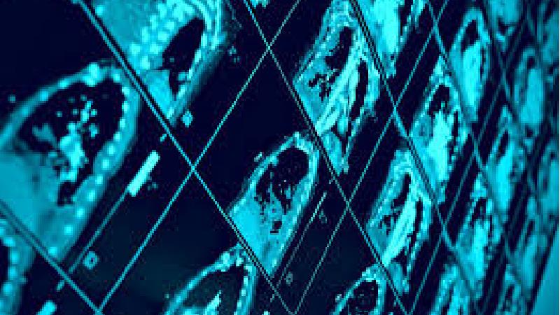 ابتلا به سرطان