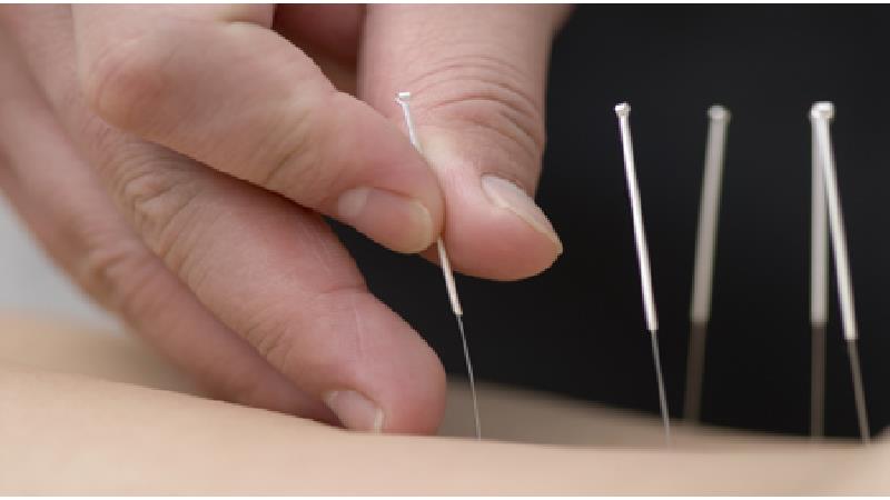 طب سوزنی برای درمان چه بیماری‌هایی مفید است؟