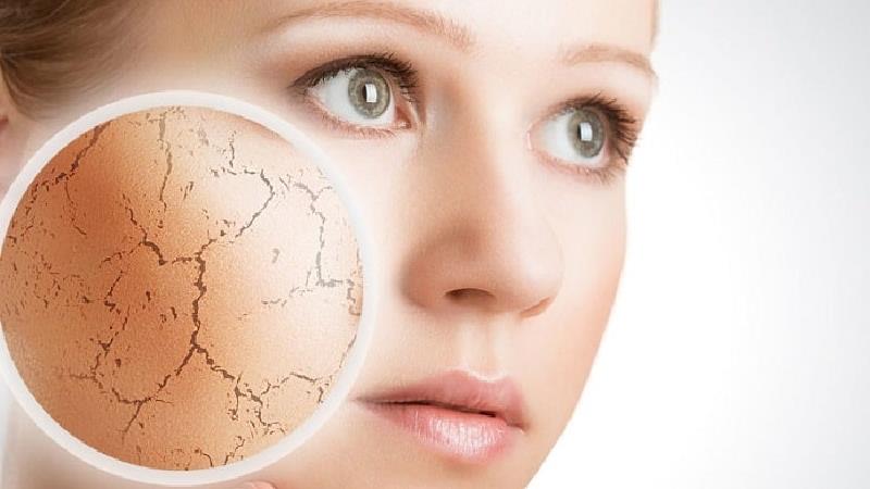 علائم خشکی پوست