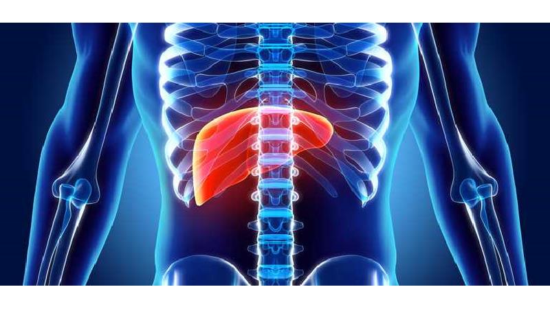 بیماری کبد چرب زمانی روی می‌دهد که چربی زیادی در کبد تجمع می‌یابد.