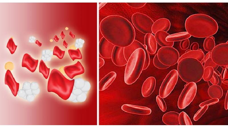 تالاسمی بیماری اکتسابی نیست و دلیل آن همیشه موروثی  می‌باشد که از پدر و مادر به فرزندان انتقال می‌یابد.