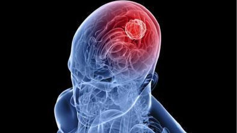 مصرف زیاد فولیک اسید باعث زوال عقل می شود