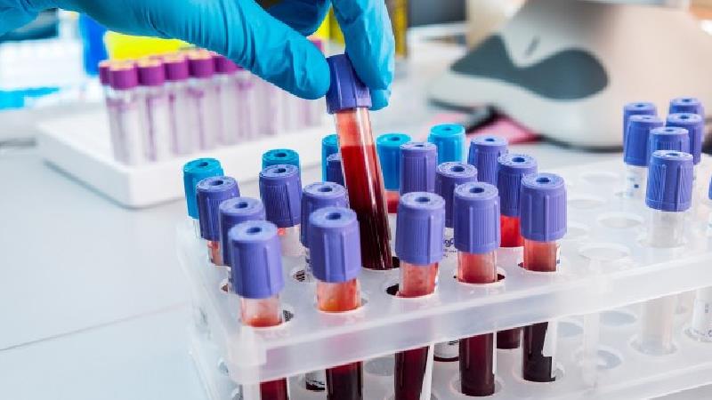 تشخیص سرطان با آزمایش خون