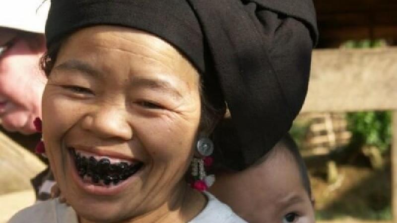 عجیب‌ترین کارهای انسان برای زیبایی