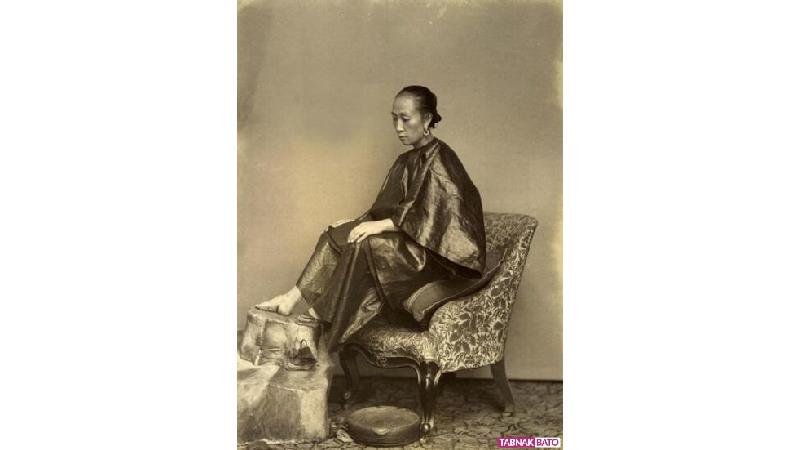 عجیب‌ترین کارهای انسان برای زیبایی