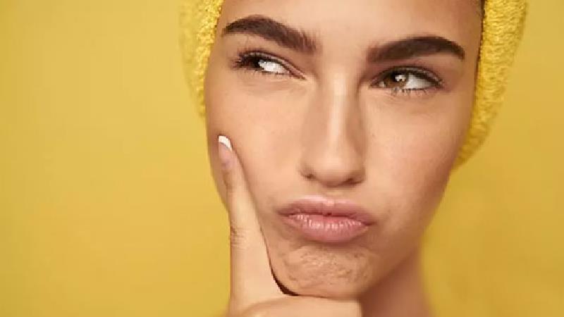 فیشیال پوست چگونه است