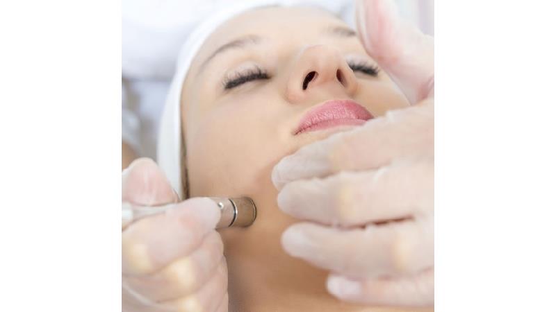 استفاده از میکرودرم یکی از رازهای جوان ماندن پوست افراد مشهور است