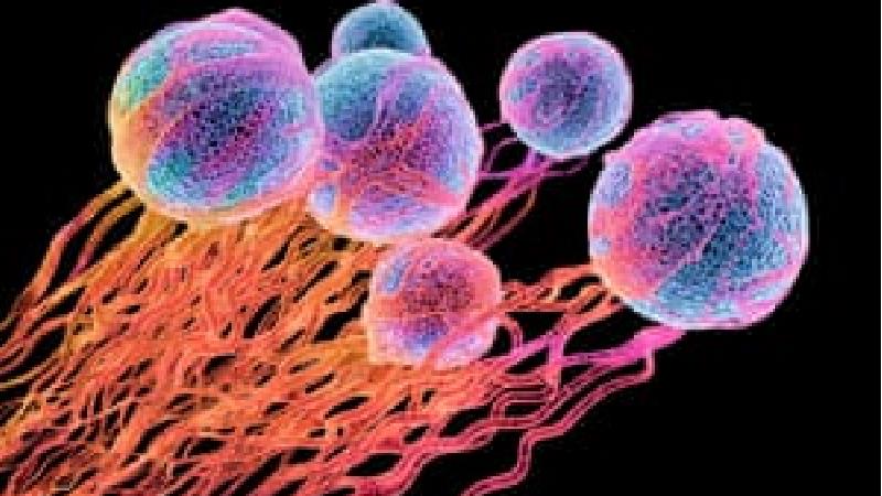 علایم سرطان در مردان چیست