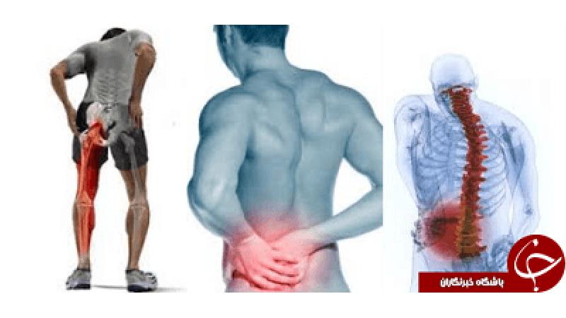 برای درمان سیاتیک چه کنیم