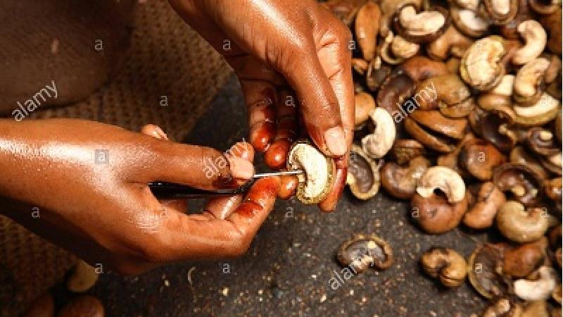 بادام هندی حاوی زینک است