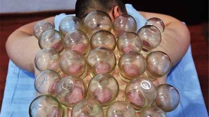 بادکش درمانی برای چه بیماری هایی موثر است