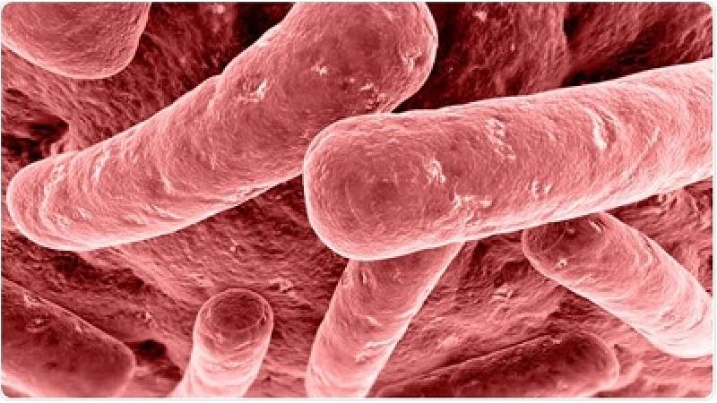 بوتولیسم چه علایمی دارد