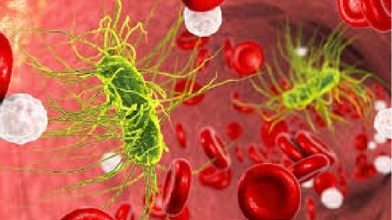 سپسیس با چه نشانه هایی همراه است