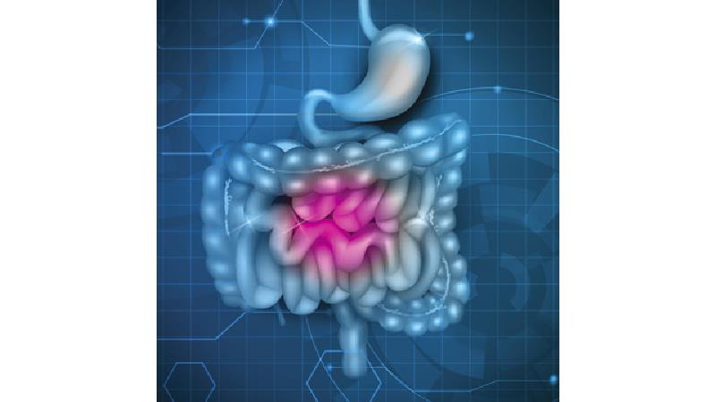 یبوست دارای علایم زیادی  است