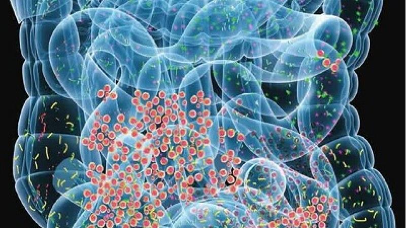 نسبت به ناراحتی های گوارشی حساس باشید