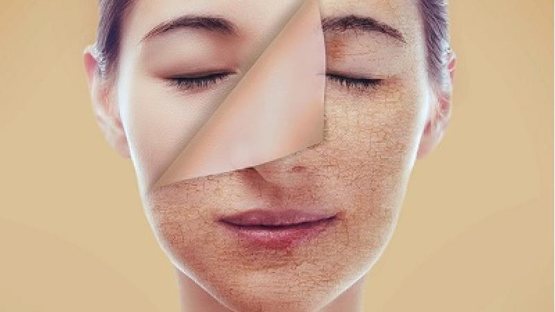 خشکی پوست را چه طور برطرف کنیم