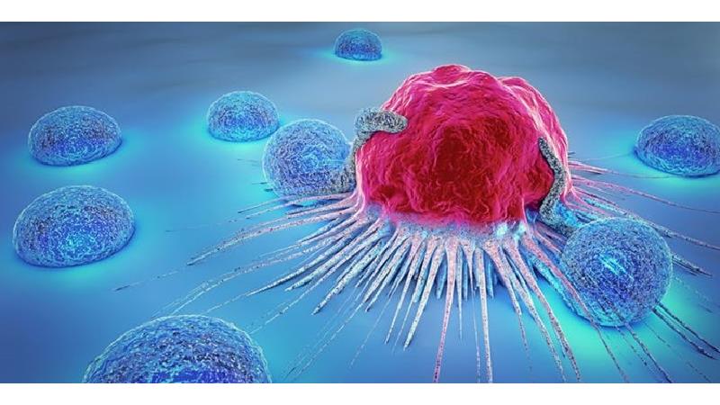 سرطان سینه چه نشانه هایی دارد