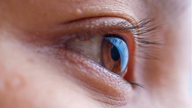 آبریزش چشم دلیل های مختلفی دارد