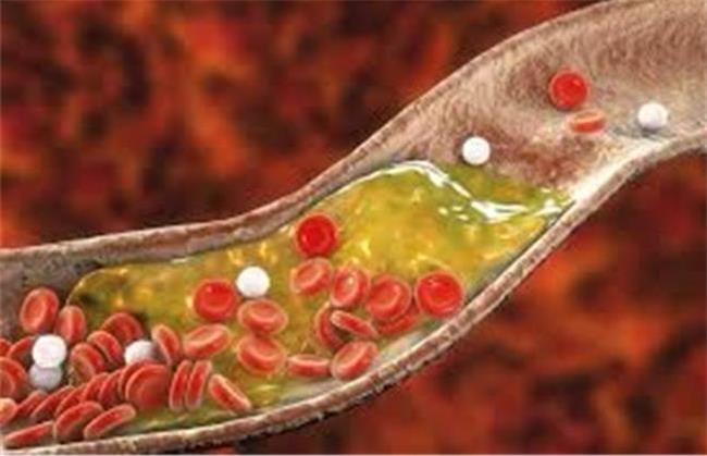 کلسترول خون را چگونه بدون دارو کاهش بدهیم