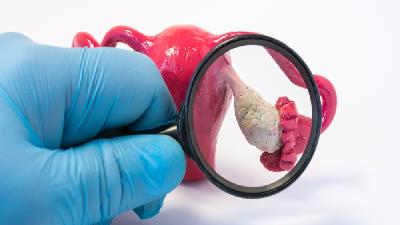 آیا تنبلی تخمدان قابل درمان است