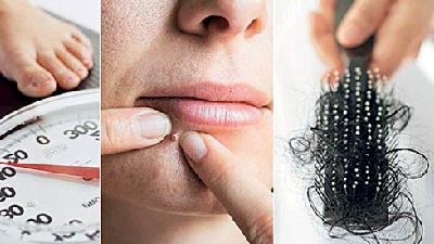 تنبلی تخمدان در زنام چه علائم و نشانه هایی دارد