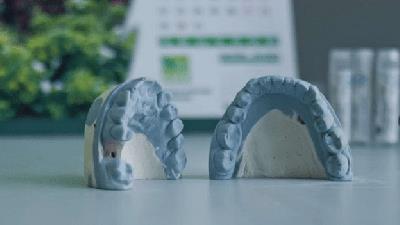 انواع مواد قالبگیری دندان