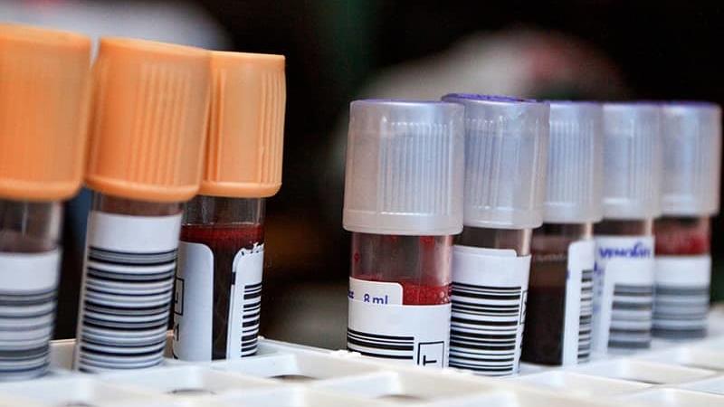 آیا میان گروه خونی و کرونا رابطه ای وجود دارد