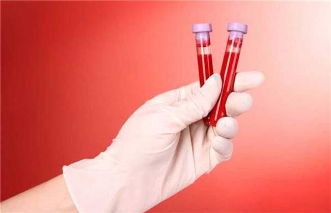 غلظت خون چه علایمی دارد