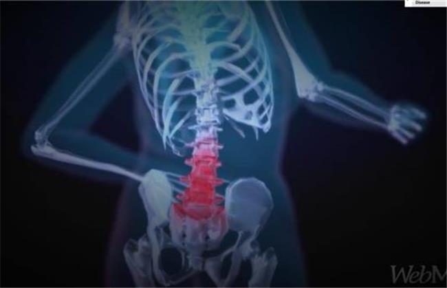 ترب سفید برای استخوان ها خوب است