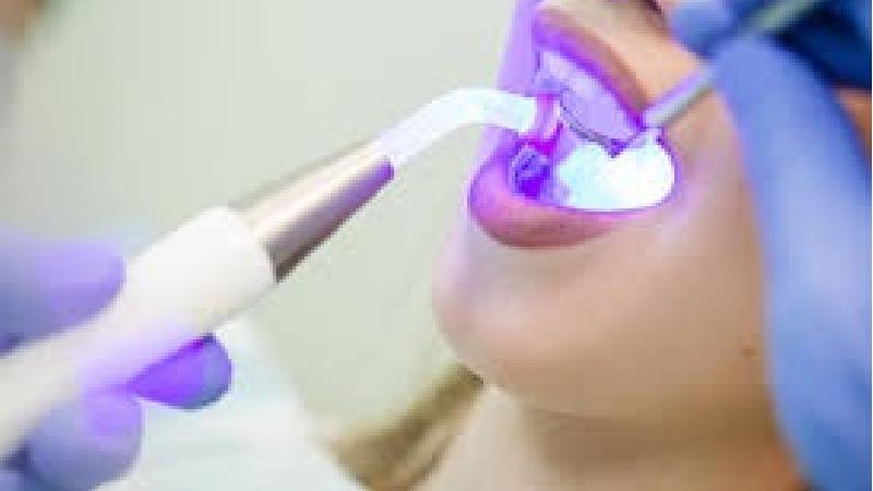 کامپوزیت دندان چگونه انجام می شود
