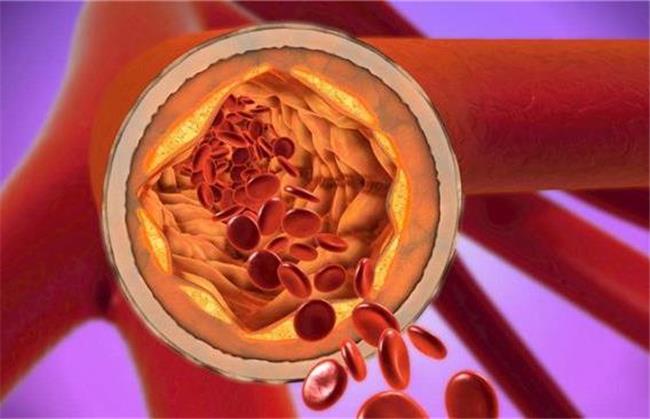 برای کاهش کلسترول خون از روش های طبیعی اقدام کنید