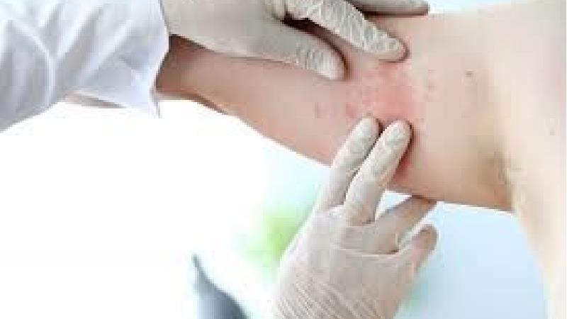 سرطان پوست را چگونه می توان درمان کرد