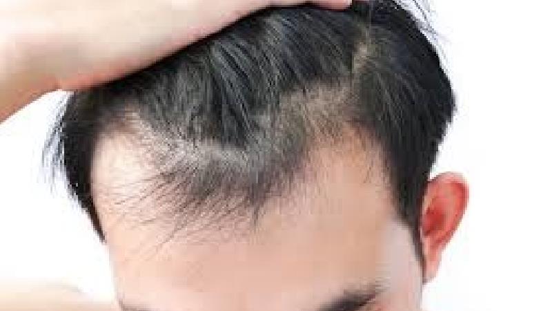 ماساژ به رشد مو کم می کند