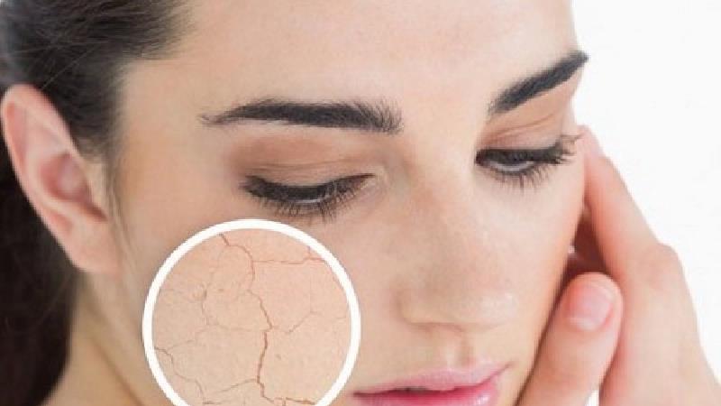 طب سنتی برای درمان و رفع خشکی پوست چه نسخه ای دارد