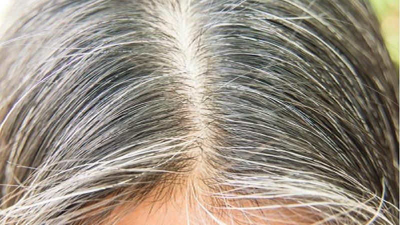 برای پیشگیری از سفید شدن مو چه کارهایی می توان انجام داد