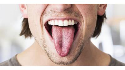 زبان سالم چه رنگی است