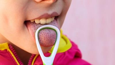 تغییر رنگ زبان کودکان چه دلایلی دارد