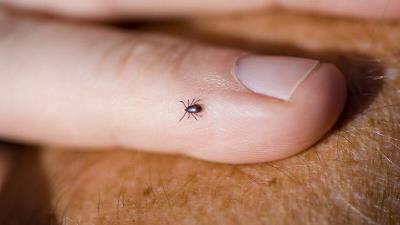 ابتلا به بیماری تب کریمه کنگو چه دلایلی دارد