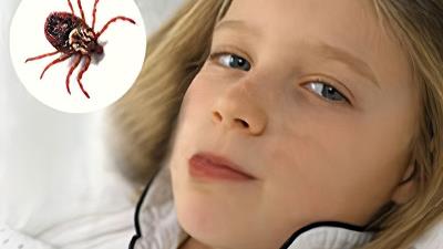 آیا تب کریمه کنگو قابل درمان است