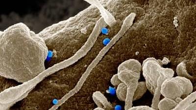با علائم بیماری تب کریمه کنگو آشنا شوید