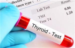آزمایش تیروئید قبل از بارداری اهمیت زیادی دارد