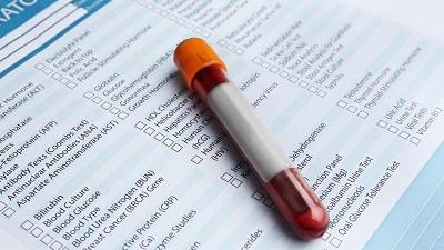 چکاپ دوره ای افراد سالخورده چگونه است