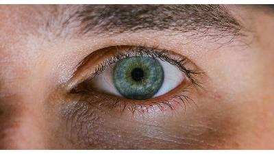 برای درمان و رفع سیاهی زیر چشم چه کار باید بکنیم