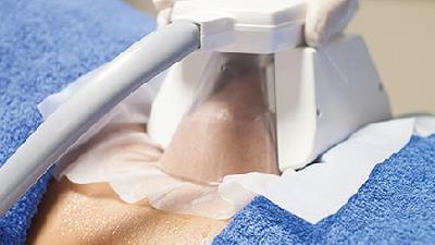 کرایولیپولیز چگونه باعث لاغری می شود