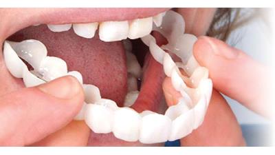 عوارض استفاده از لمینت متحرک دندان چیست