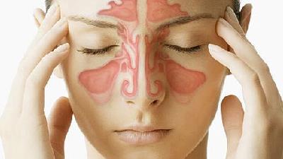 روش های درمان بیماری سینوزیت چیست